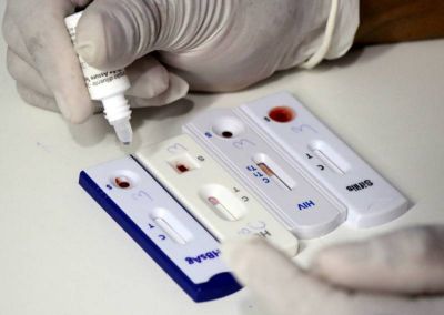 notícia: Ananindeua reforça diagnóstico precoce com mais de 75 mil testes rápidos para ISTs em 2025
